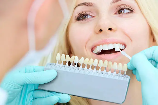 Close up of denturist comparing dental teeth colours with patients natural colour