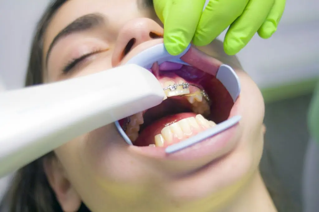 Woman receiving a digital dental scan